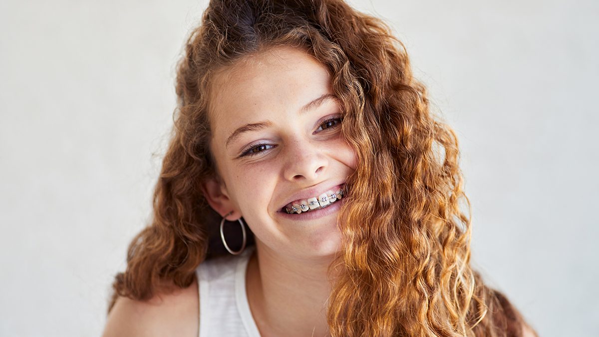 Os 6 melhores produtos para os teus dentes se usas aparelho dentário