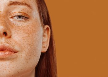 retinoides, qué son y para qué sirven