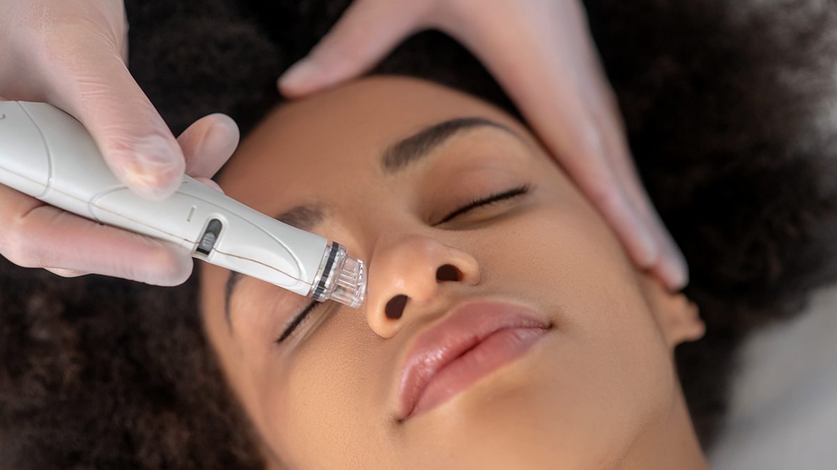 Tu rutina beauty lo está pidiendo: necesitas incorporar un aspirador de puntos negros