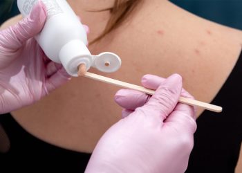 Acné corporal: cómo eliminarlo