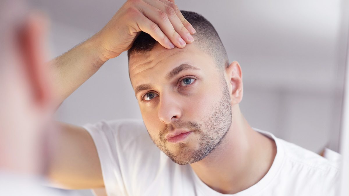 Qué es la dermatitis seborreica y cómo evitarla