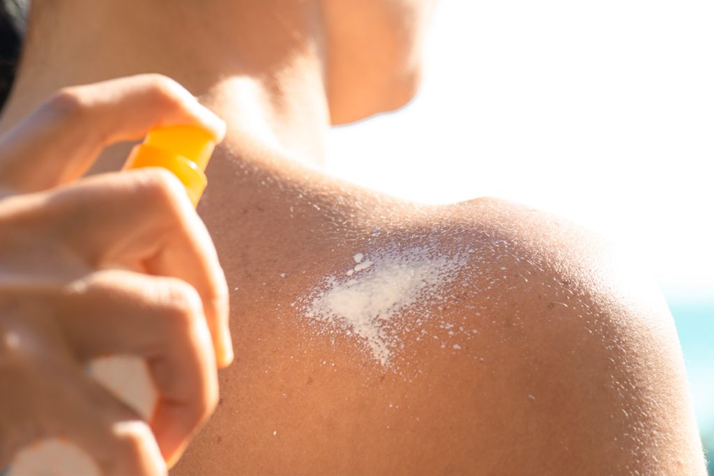 Esto es todo lo que debes saber sobre la alergia al sol