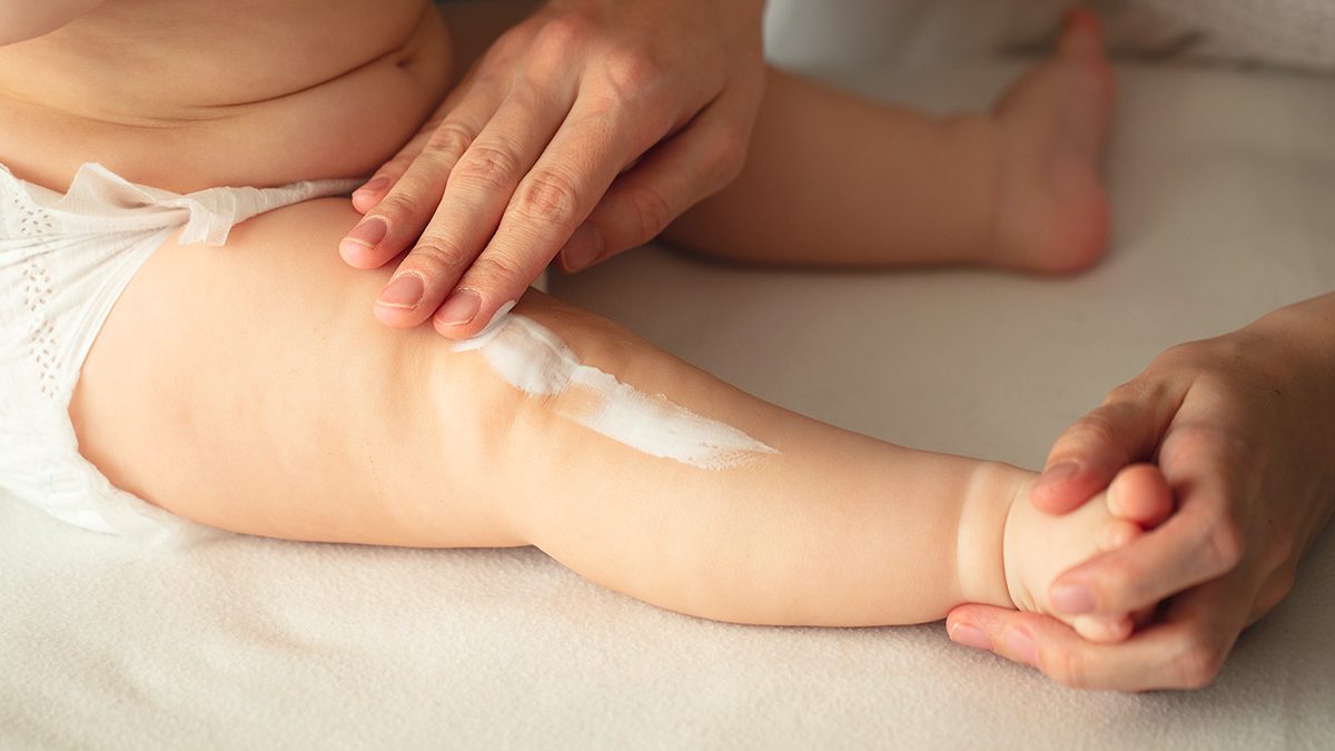 Cómo tratar la piel atópica en niños y bebés: los mejores trucos y cremas