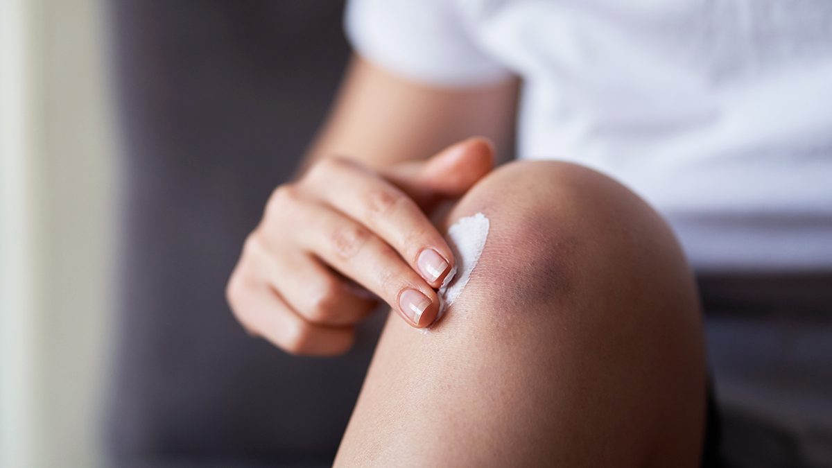 Las mejores cremas para los golpes antiinflamatorias de adultos, recomendadas por expertos