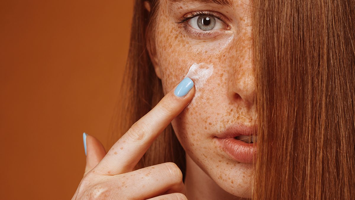 Melasma: qué es y cuáles son las mejores cremas para eliminarlo