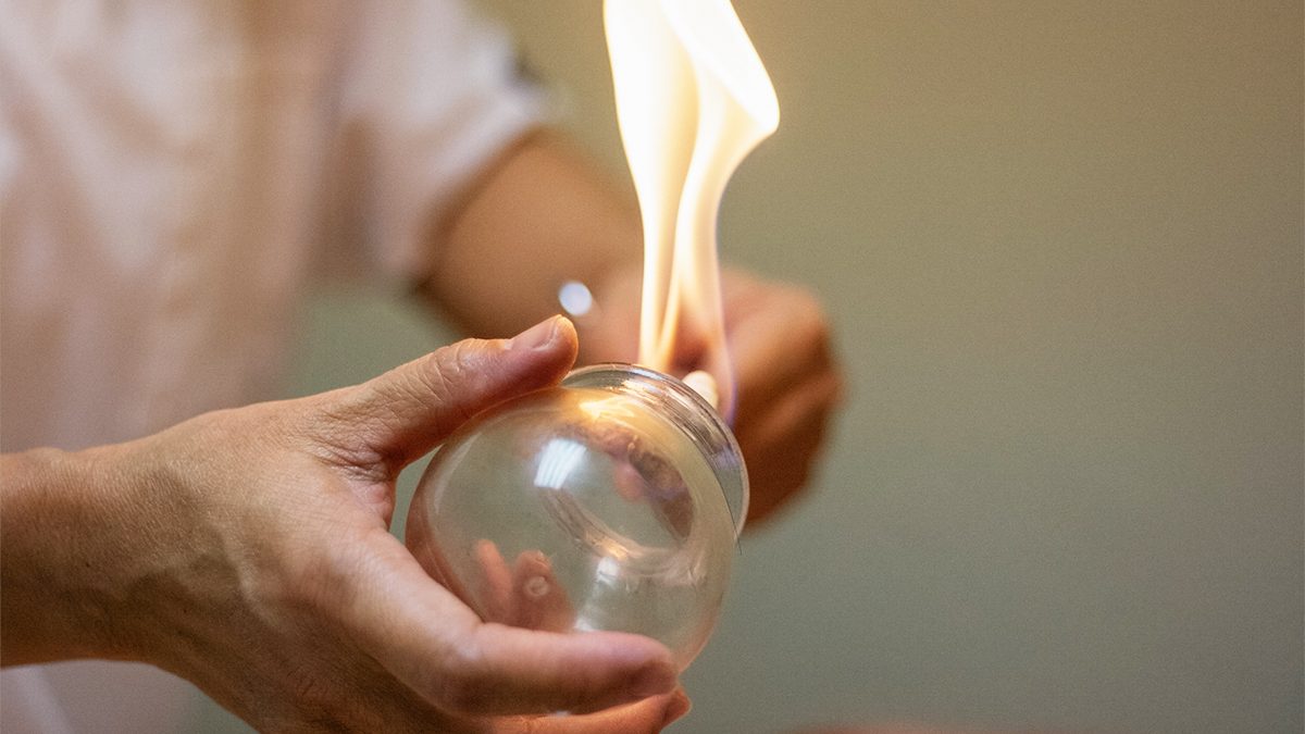 Qué es la ventosaterapia y todos sus beneficios