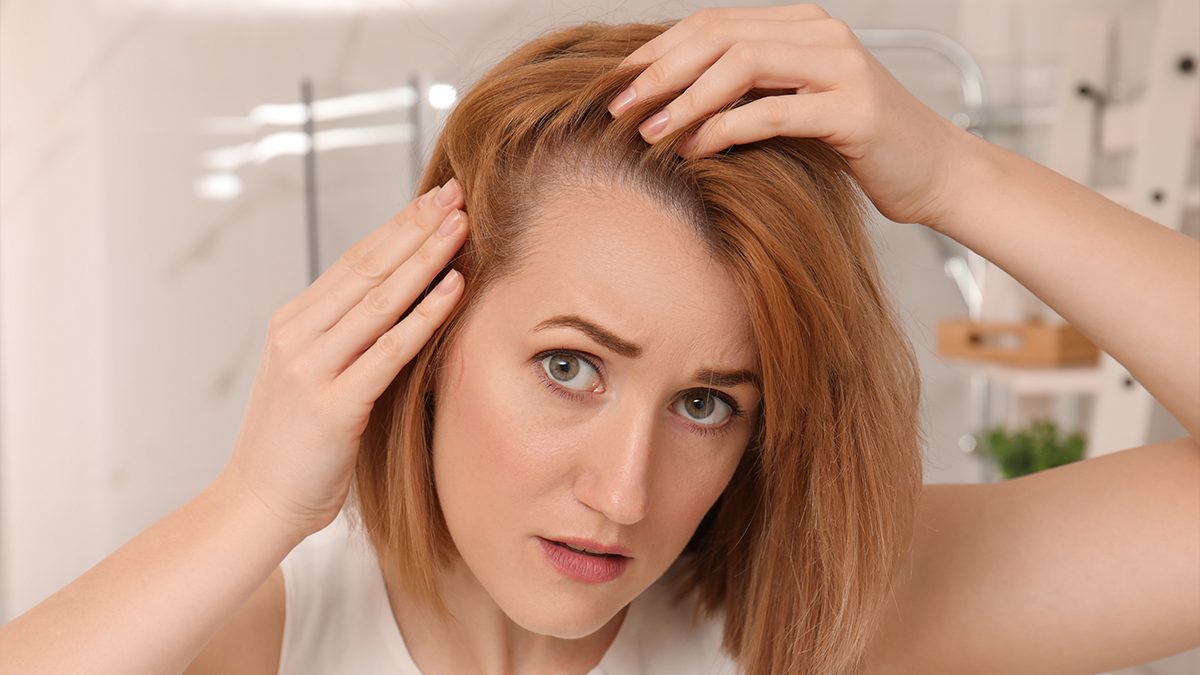 Los mejores tratamientos naturales para evitar la alopecia femenina