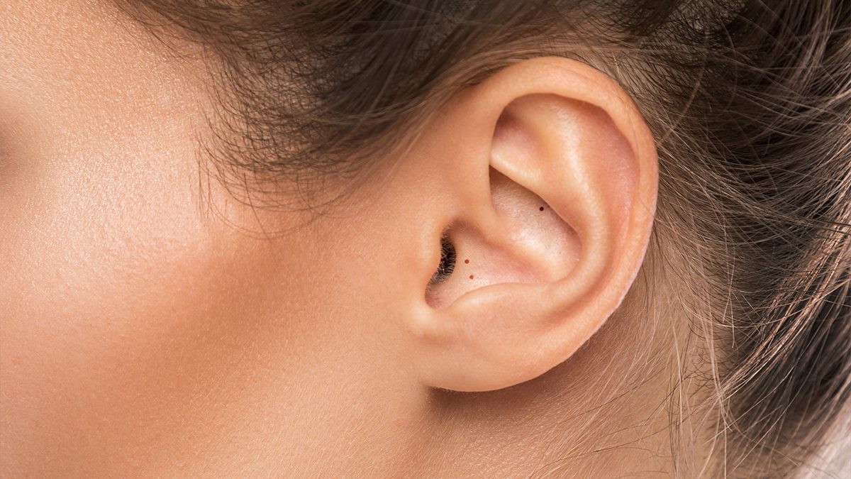 Elimina espinillas y puntos negros de la oreja de forma segura con trucos y productos