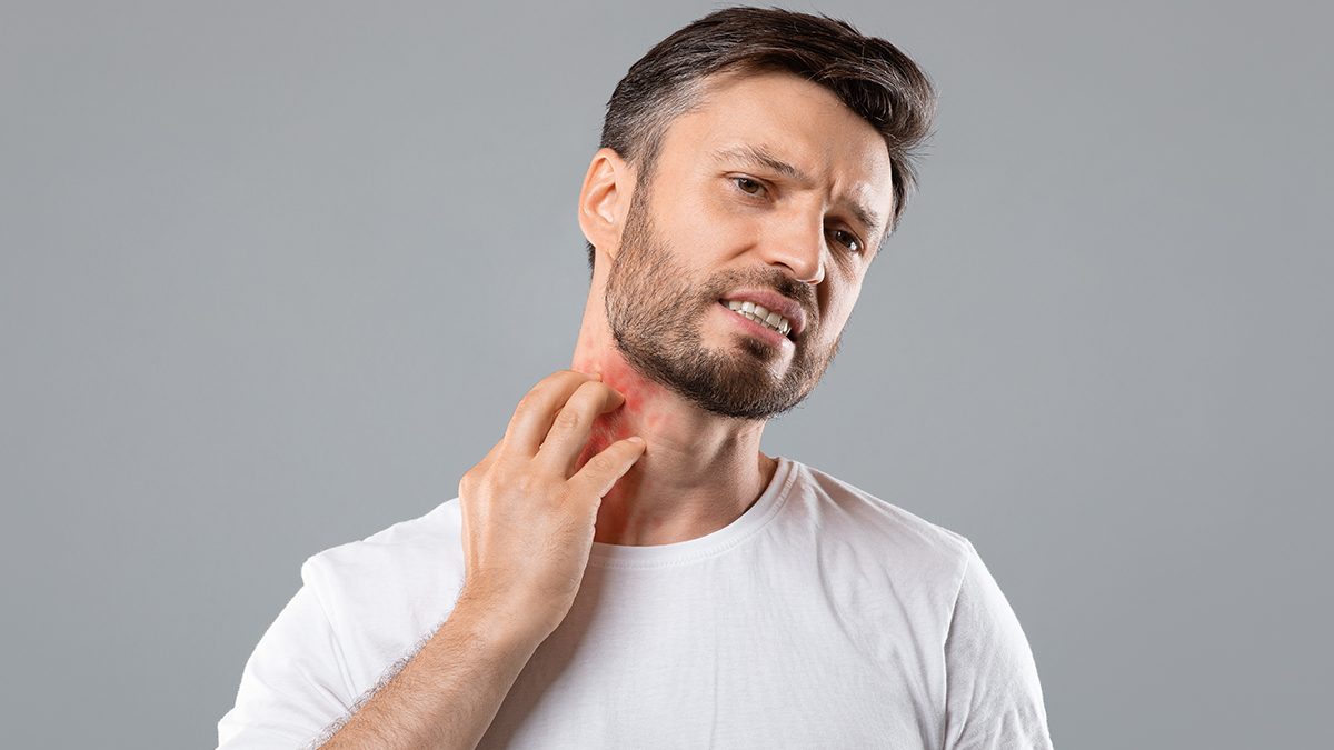 Sarpullido en el cuello: las posibles causas y las mejores soluciones
