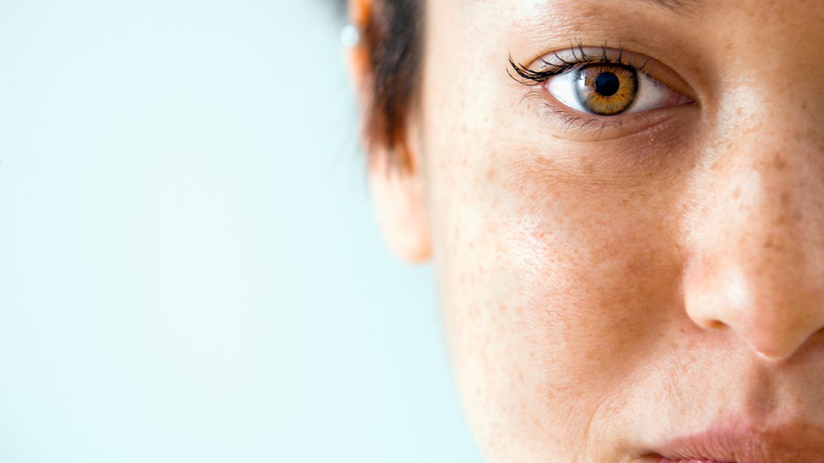 Paño de la cara: qué es y cómo quitarlo según expertos