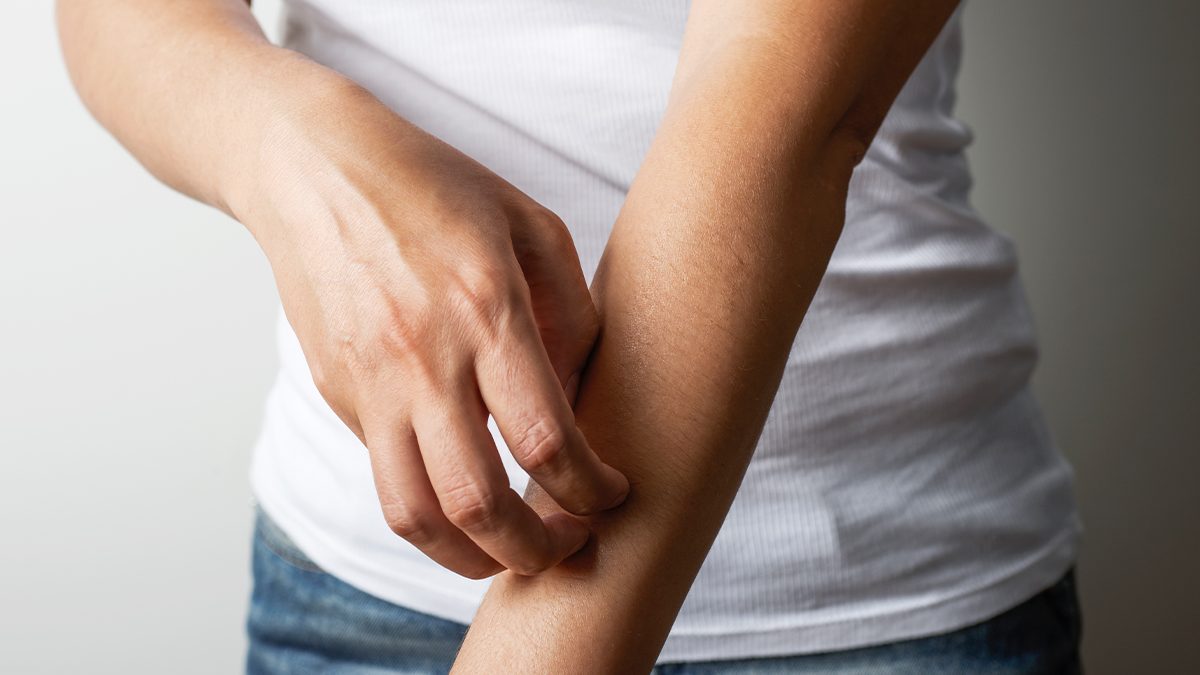 Cómo identificar el tipo de picadura: los mejores tratamientos para una picadura