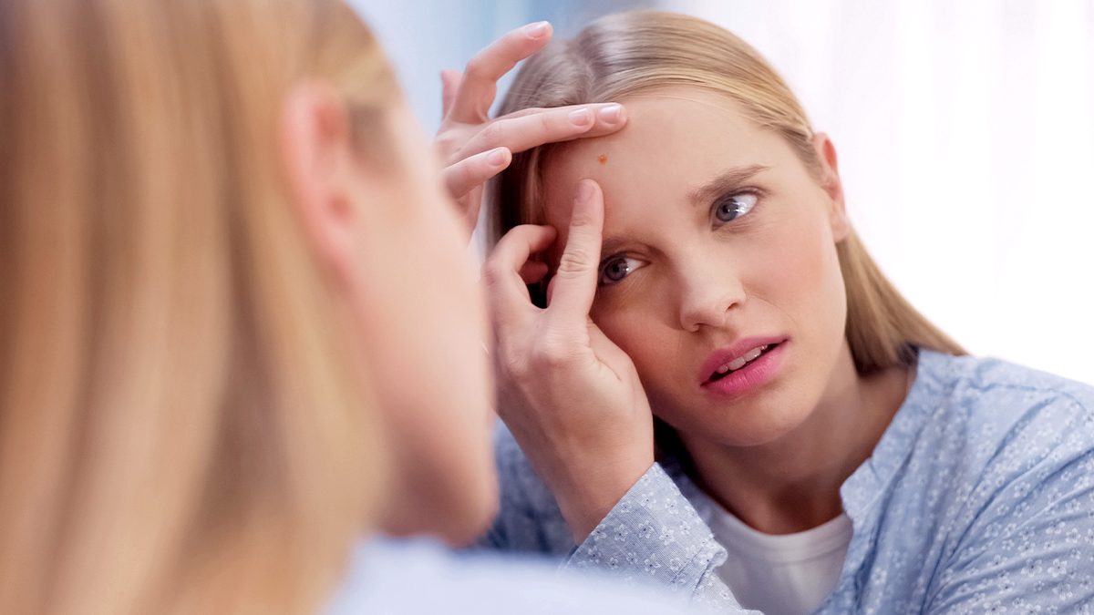 Acné hormonal: por qué sale y qué rutinas debes seguir según los expertos