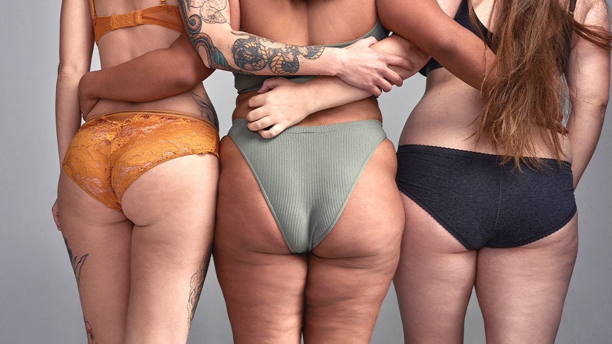 Celulitis: qué es, por qué sale y cuáles son los tipos que debes conocer