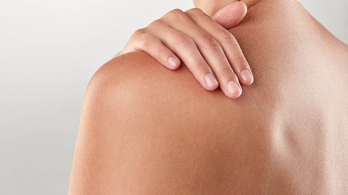 Cómo cuidar la piel durante un tratamiento de quimioterapia según los expertos