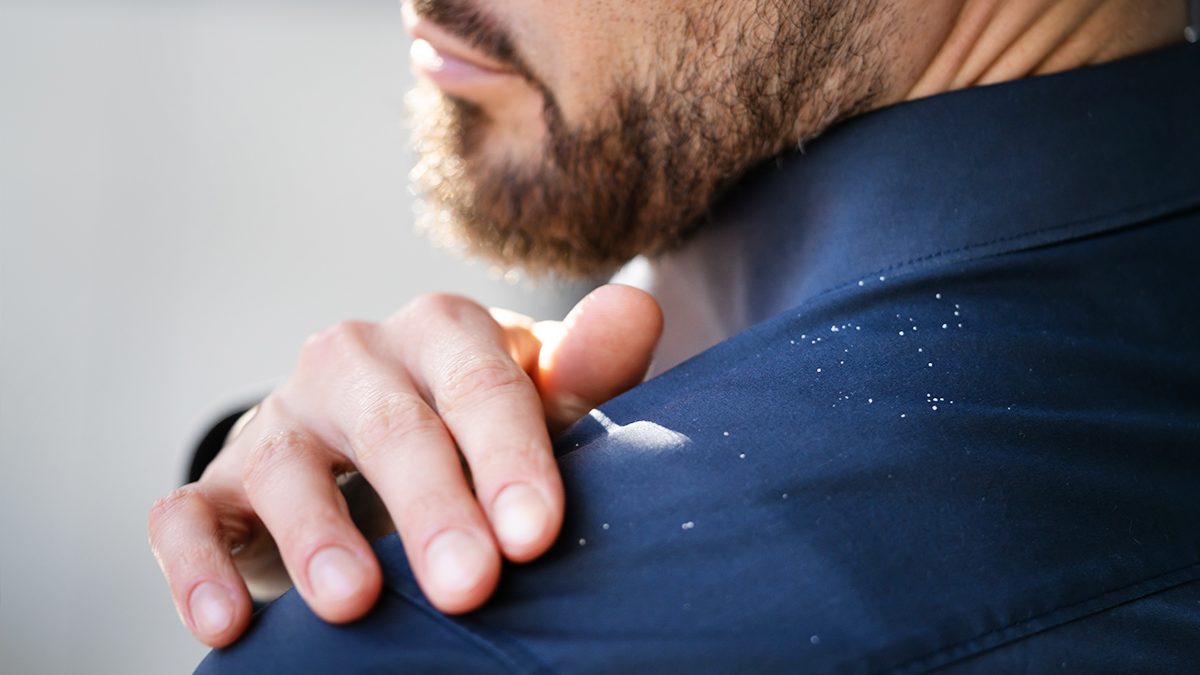 Ketoconazol: qué es y cuáles son sus beneficios