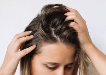 Te contamos cuáles son las principales causas de la caída de pelo en mujeres.