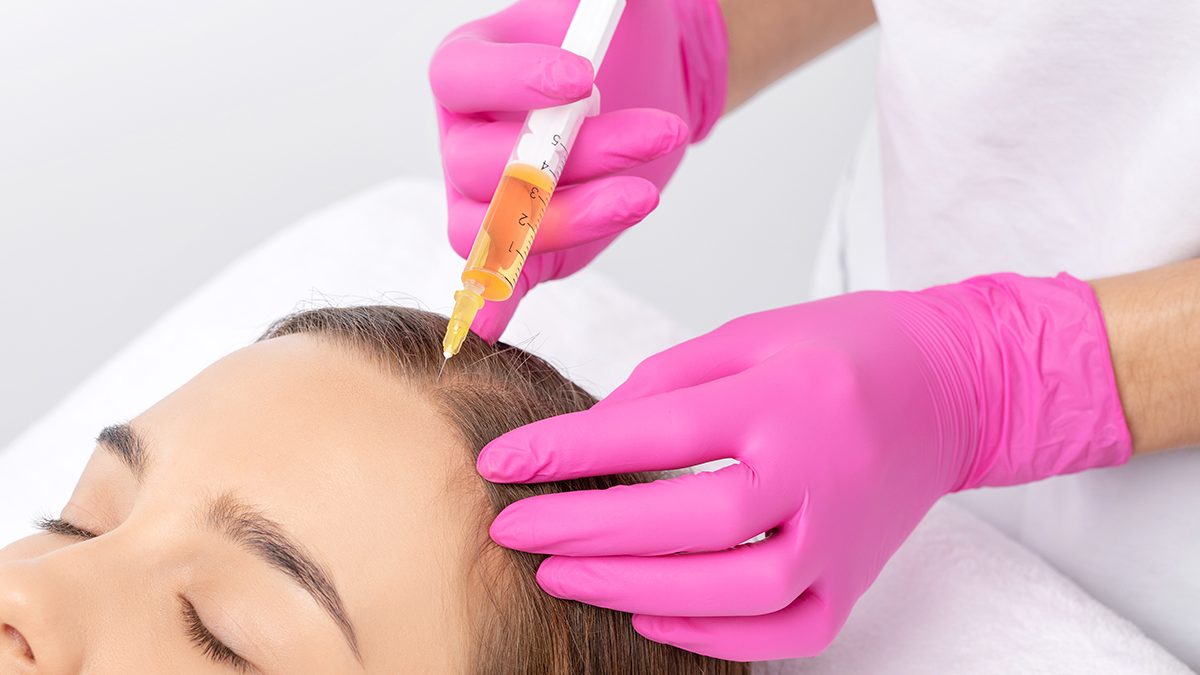 Microneedling capilar: qué es, cómo es el procedimiento y qué beneficios tiene