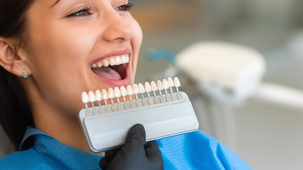 Todo lo que debes saber antes de hacerte un blanqueamiento dental: pros y contras en 2026