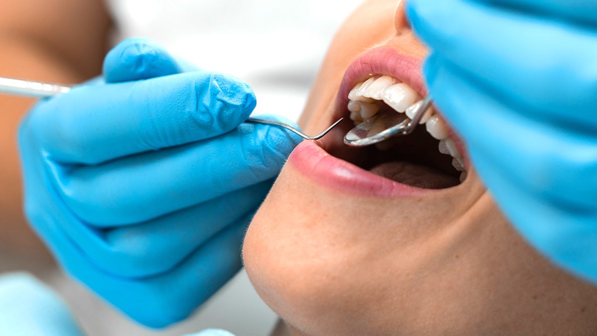 Cómo saber si debes acudir a un dentista: consejos y recomendaciones